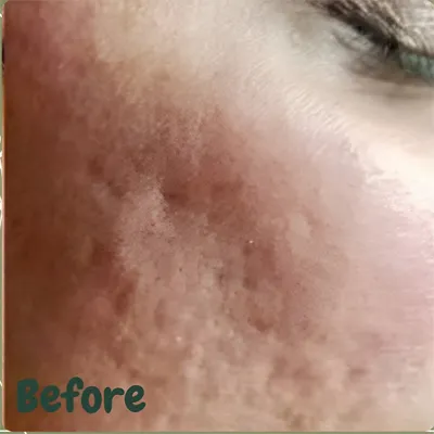 قبل